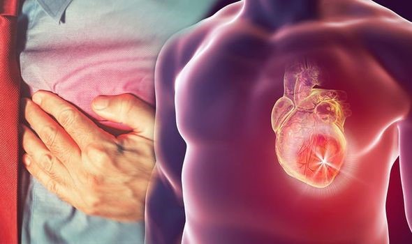 Ce este si cum se produce infarctul de miocard?