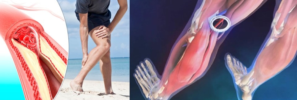 durere la nivelul mușchilor și articulațiilor gambei