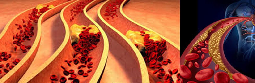 Cum reducem colesterolul şi trigliceridele pentru a avea o inimă sănătoasă?