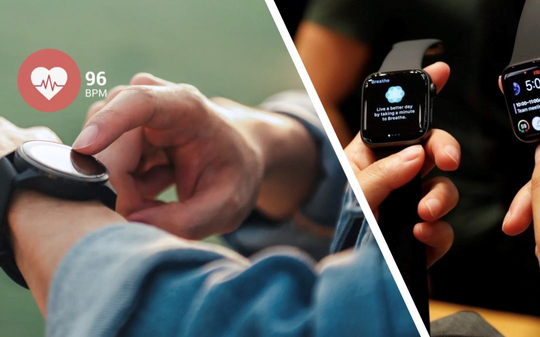 Holter ECG versus smartwatch
