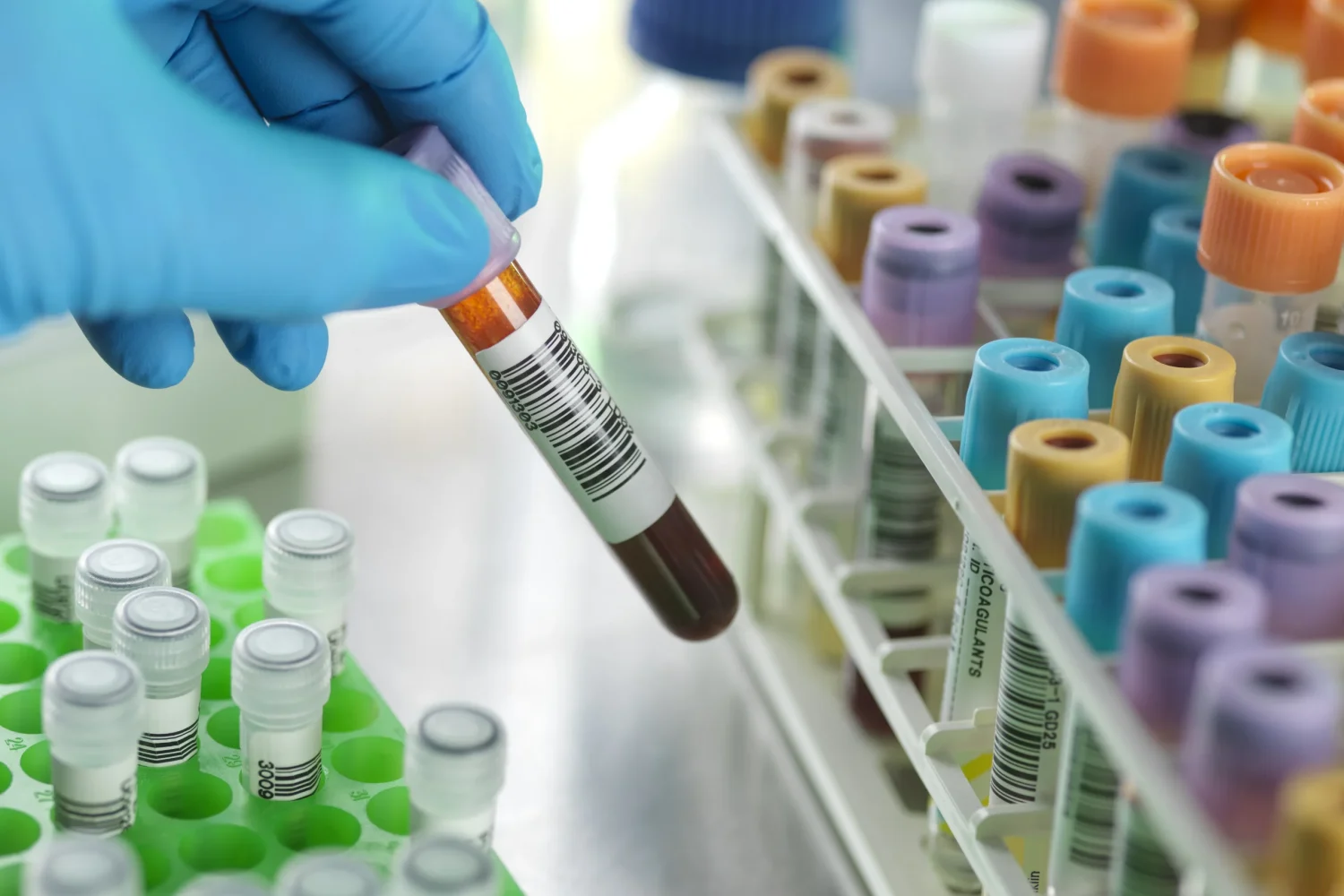 Screening dislipidemie – colesterol